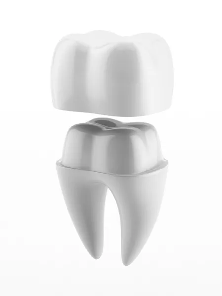 Transform Your Smile and Boost Your Confidence with Dental Crowns